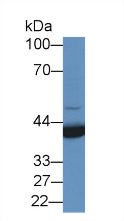 14055