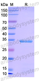YMM03701, SDS-PAGE