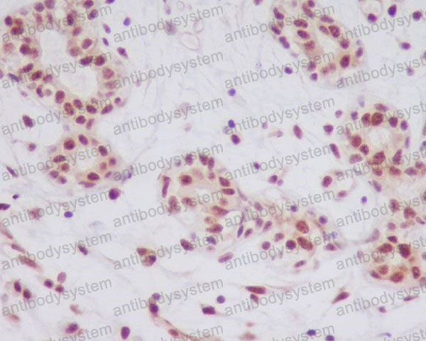 Валидация AntibodySystem RHE45802 (2174)