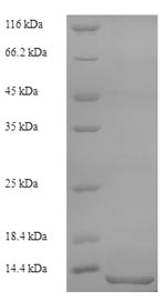 SDS-PAGE