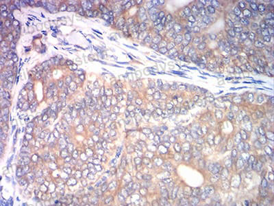 Валидация AntibodySystem RHD75203 (1806)