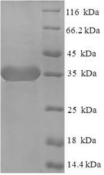 SDS-PAGE