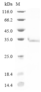SDS-PAGE
