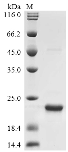SDS-PAGE