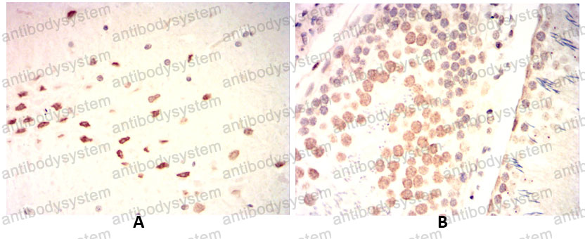 Валидация AntibodySystem RHG96902 (3132)