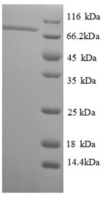 SDS-PAGE