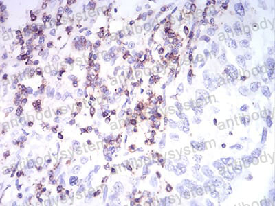 Валидация AntibodySystem RHC20802