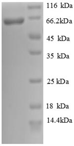 SDS-PAGE