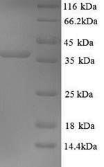 SDS-PAGE