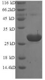 SDS-PAGE