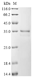 SDS-PAGE