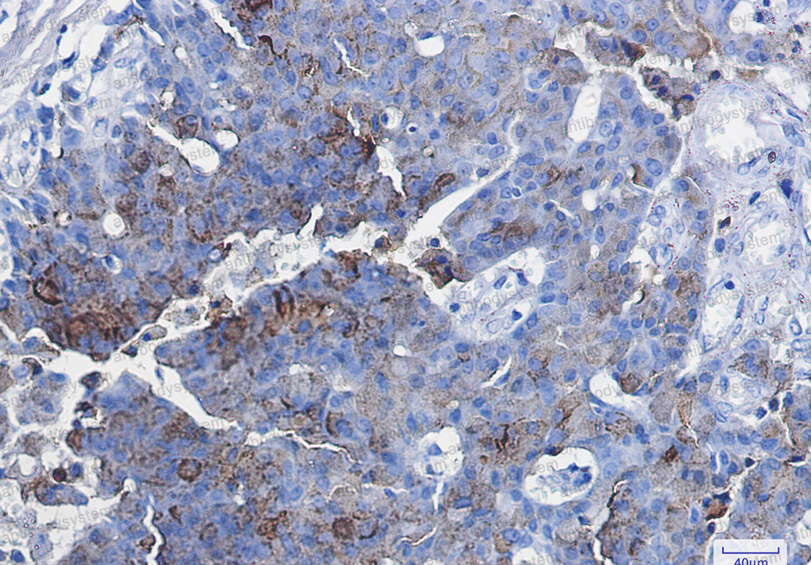 Валидация AntibodySystem RHC37601