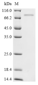 SDS-PAGE
