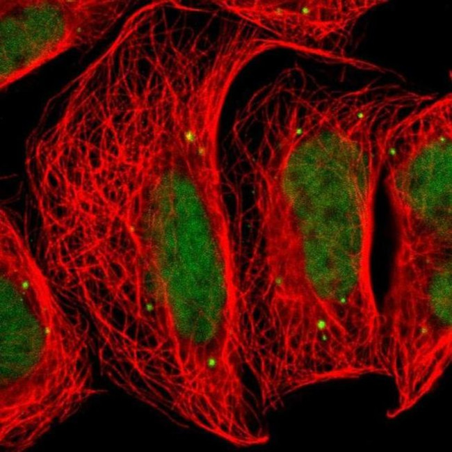 Валидация AssayVector ARM1638(1772)