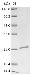 SDS-PAGE
