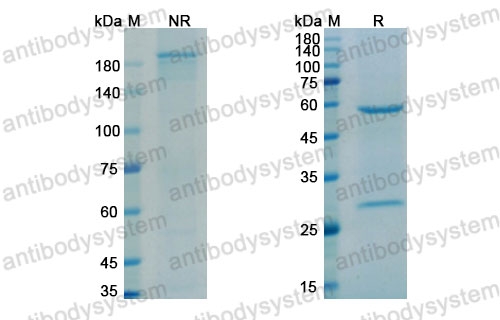 Валидация SDS-PAGE - AntibodySystem DVV00304