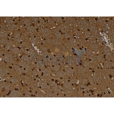 Валидация Affinity DF8761 - 20785