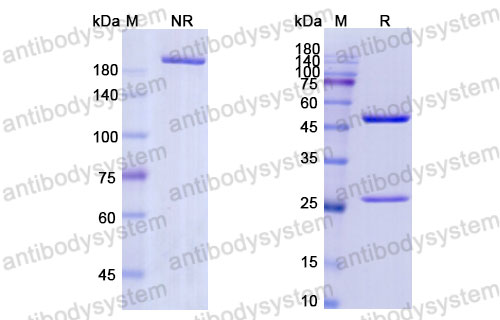 Валидация SDS-PAGE - AntibodySystem DHD17207