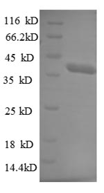 SDS-PAGE