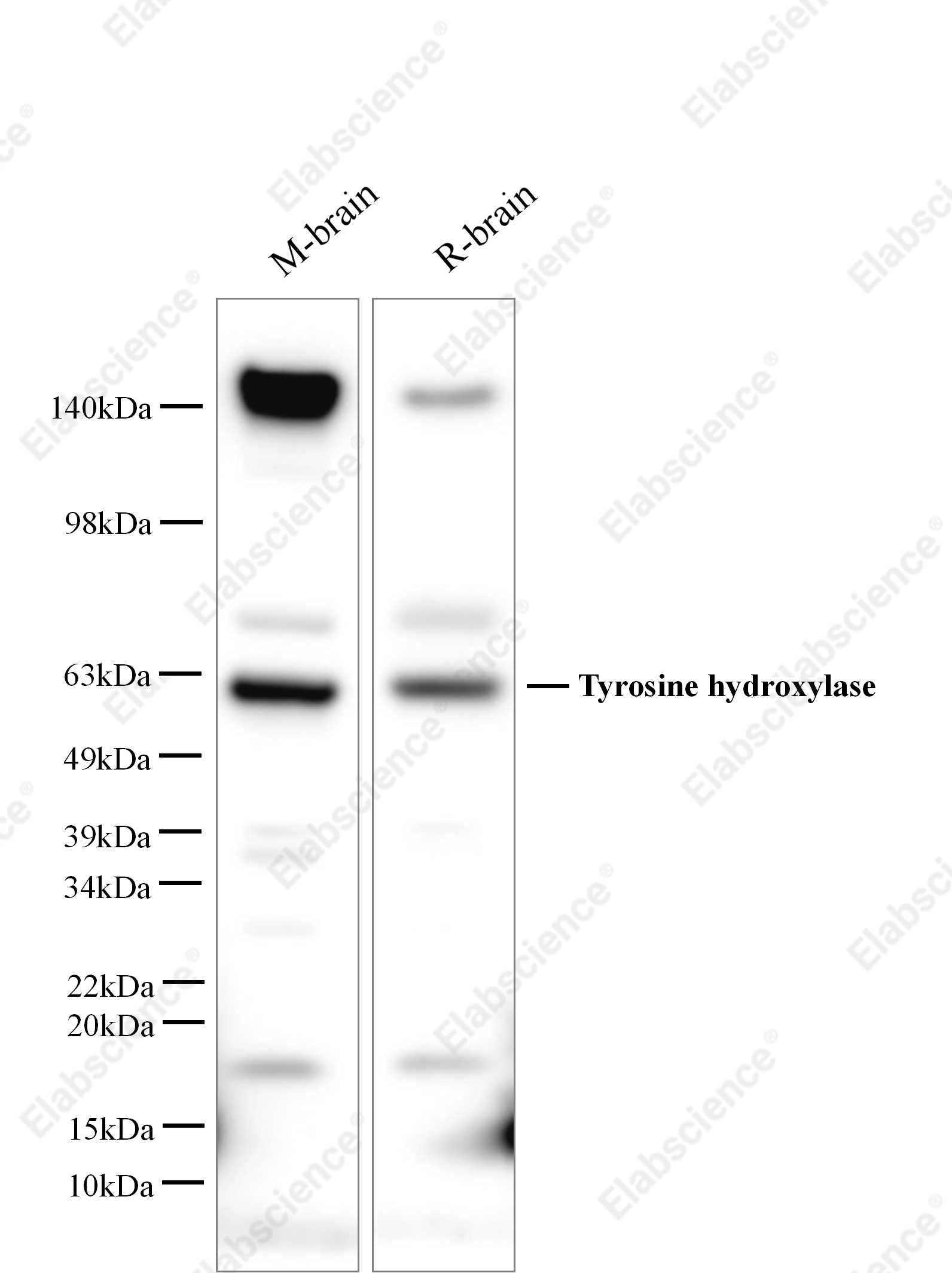 Вестерн-блоттинг, Tyrosine hydroxylase, мозг мыши, клетки PC-12, мозг крысы