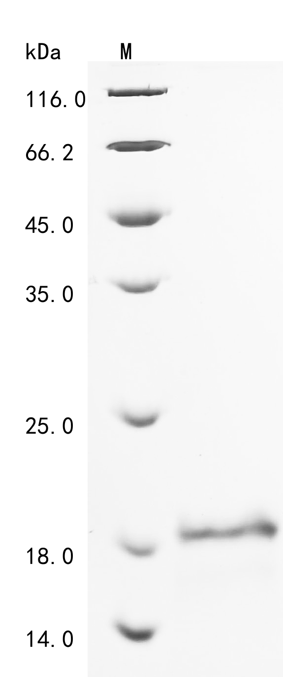 SDS-PAGE