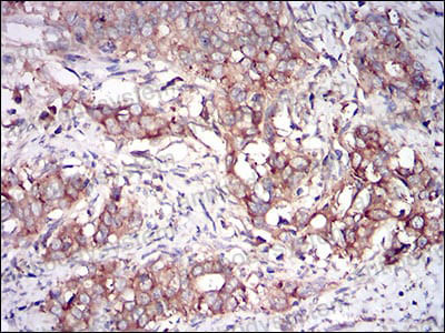 Валидация AntibodySystem RHD34504 (1510)