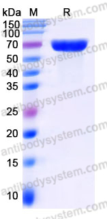 EHJ09702, SDS-PAGE