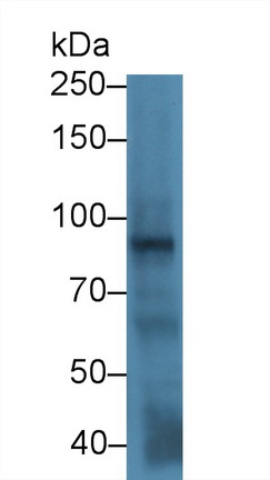 13916