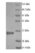 SDS-PAGE