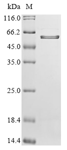 SDS-PAGE