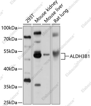 Вестерн-блоттинг, ALDH3B1, различные клеточные линии