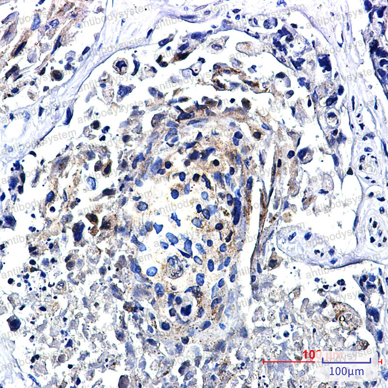 Валидация AntibodySystem RHD34401