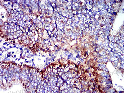 Валидация AntibodySystem RHC97405