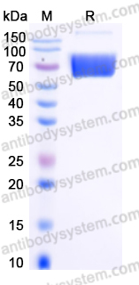 EHC00702, SDS-PAGE