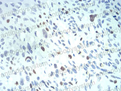 Валидация AntibodySystem RHE91402