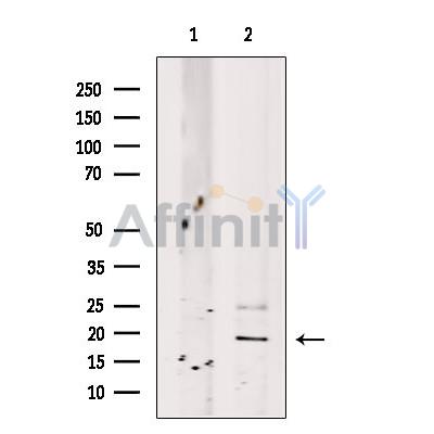 Валидация Affinity DF13595 - 9081