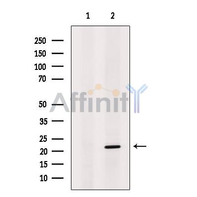 Валидация Affinity DF10073 - 5552