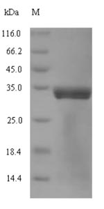 SDS-PAGE