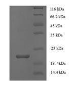 SDS-PAGE