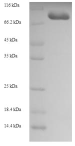 SDS-PAGE