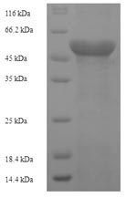 SDS-PAGE