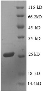 SDS-PAGE