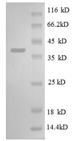 SDS-PAGE
