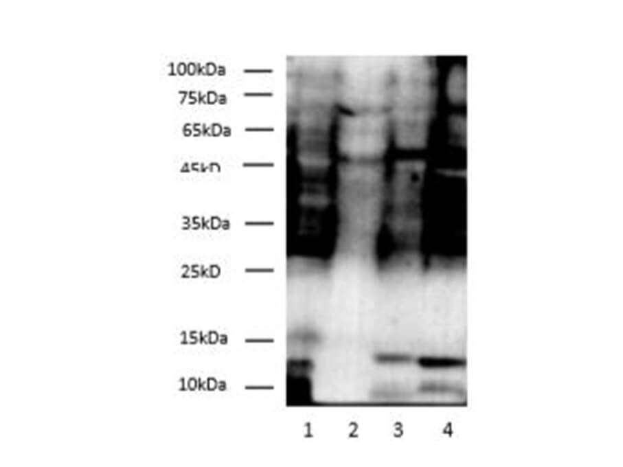 Вестерн-блоттинг, Dimethyl-Lysine, E. coli, тимус и мозг мыши, клетки HeLa