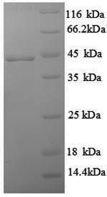 SDS-PAGE