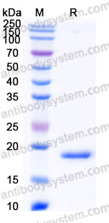 YHF19805, SDS-PAGE