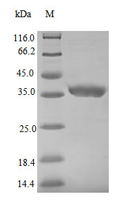 SDS-PAGE