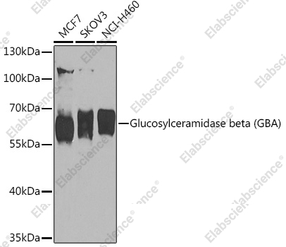 Вестерн-блоттинг, Glucosylceramidase beta, различные клеточные линии