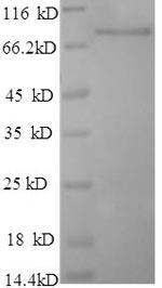 SDS-PAGE