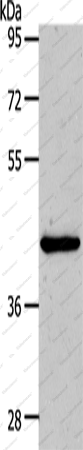 Вестерн-блоттинг, MMP13, клетки HeLa